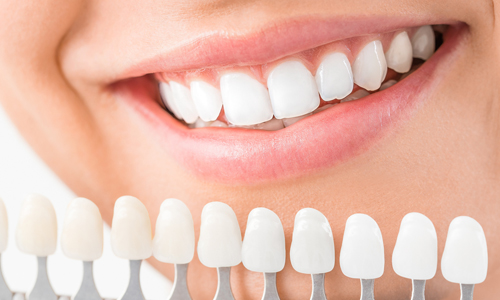 Estetik Diş Hekimliği